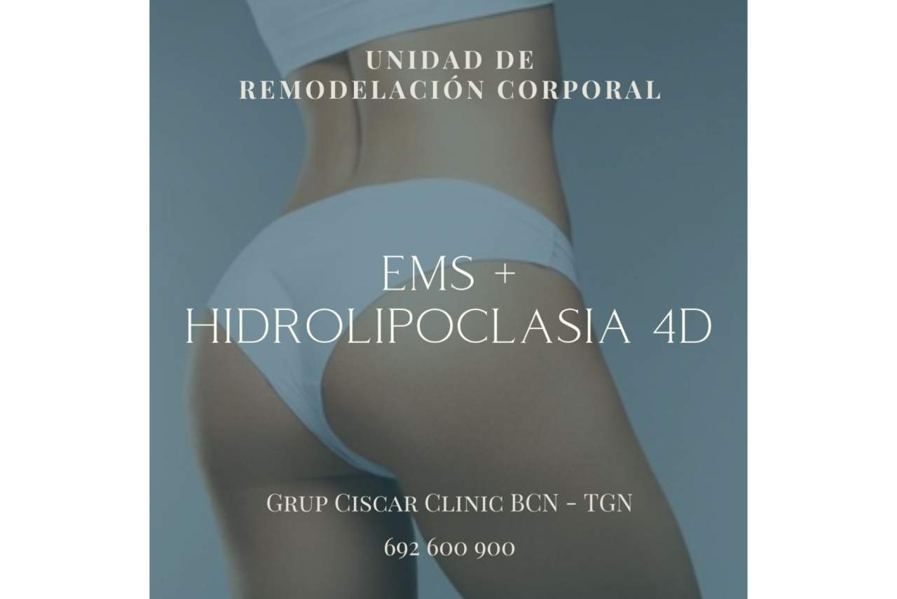 El tratamiento que permite eliminar grasa localizada en Barcelona por la Clínica Ciscar: Hidrolipoclasia 4D