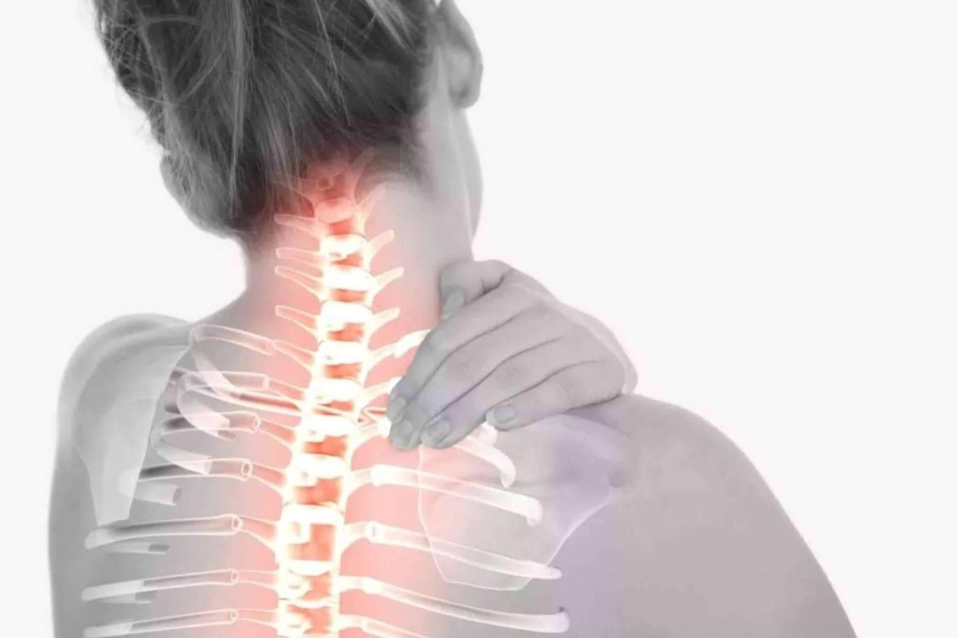 CNQ trata el dolor cervical provocado por hernias discales